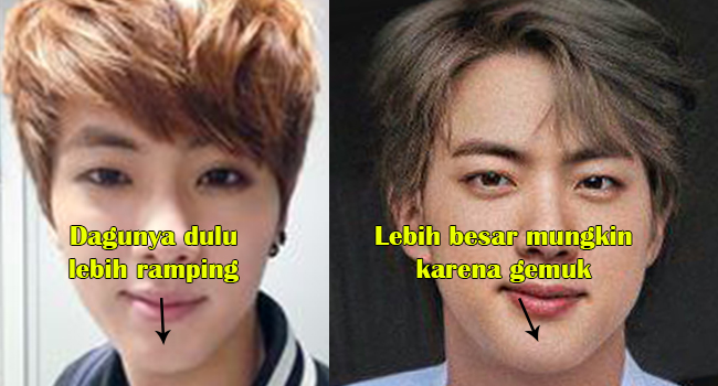 Apakah Dagu Jin BTS Oplas?